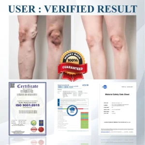 Black Cumin Edema Detox Herbal Cream - Image 4
