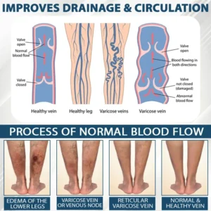 Black Cumin Edema Detox Herbal Cream - Image 7