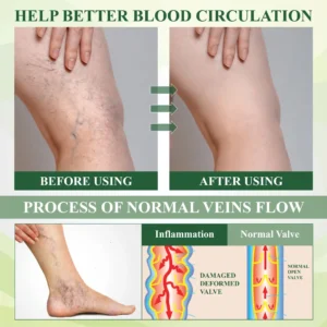 Edema Drain Duo Therapy Roller Cream - Image 7