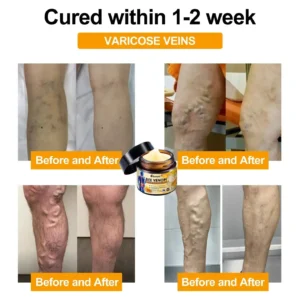 Bee Venom Instant Ultra Strength Pain Relief Therapy Cream - Image 5