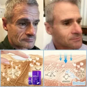 Age-Defying Lifting Serum - Image 6