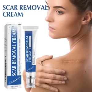 Alcuras Medical Grade Silicone Scar Cream - Image 5