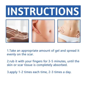 Alcuras Medical Grade Silicone Scar Cream - Image 2