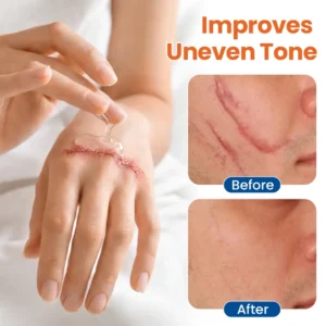 DermalRebuild Daily Renewal Gel - Image 5