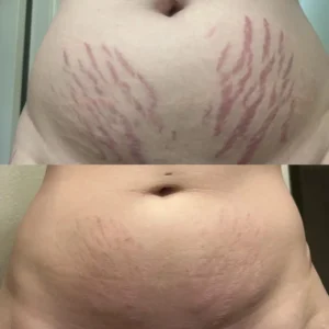 DermalRebuild Daily Renewal Gel - Image 7