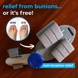 Non-Surgical Relief for Bunion Pain - Image 2