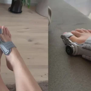 Non-Surgical Relief for Bunion Pain - Image 3