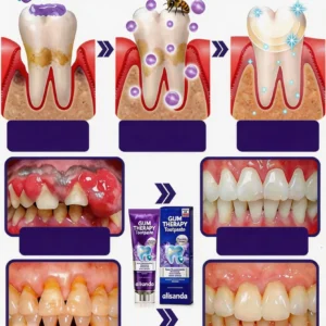VioCore Dental Treatment Toothpaste - Image 3