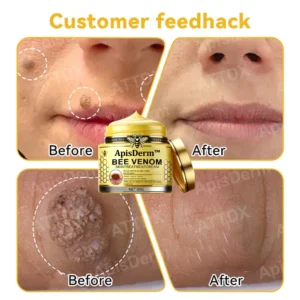 Bee Venom Skin Treatment Cream - Image 6