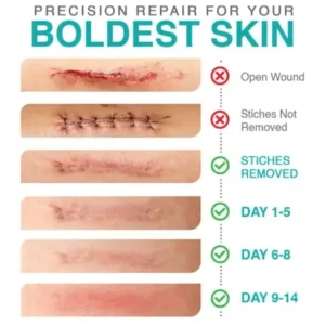 3-in-1 Microneedle Care Patch - Image 5