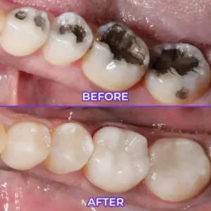 SensiGum Fluoride Toothpaste - Image 5