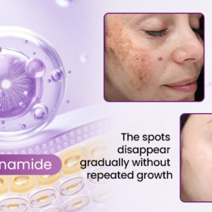 RadiantClear Blemish & Brightening Serum - Image 2