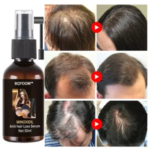 Rapid Hair Regrowth Oil - Image 6