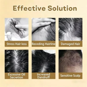 Clinclii Hair Regrowth Capsules - Image 3