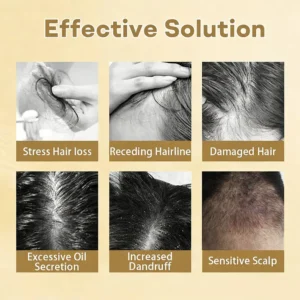 Hair Regrowth Capsules - Image 11