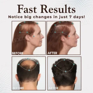 Hair Regrowth Capsules - Image 5