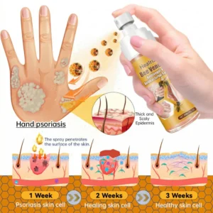 Bee Venom Antifungal & Antibacterial Spray - Image 3