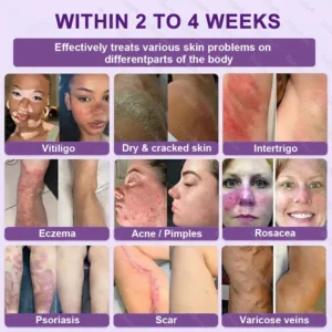 ✨Best Biotin 10-in-1 Skin Restoration Cream - Image 3