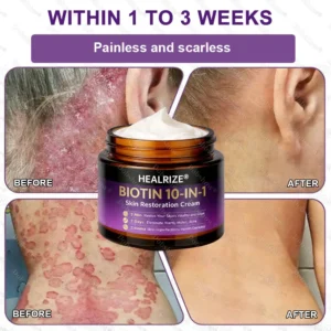 ✨Best Biotin 10-in-1 Skin Restoration Cream - Image 9