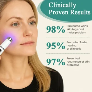 Mole and Wart Instant Removal Laser Pen - Image 3