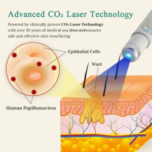 Mole and Wart Instant Removal Laser Pen - Image 5