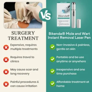 Mole and Wart Instant Removal Laser Pen - Image 8