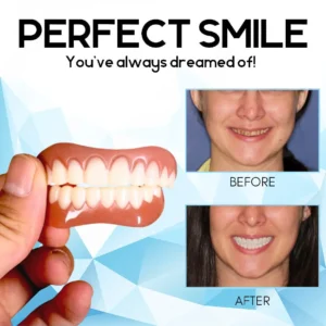 Silicone Reline Denture Set - Image 4