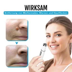 SpotlessDerm Molen- und Warzen-Laserstift - Image 5