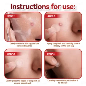Microneedles Botanical Skin Tags Solution Patches - Image 14