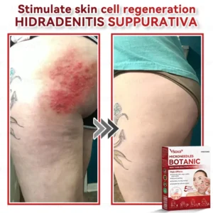Microneedles Botanical Skin Tags Solution Patches - Image 8