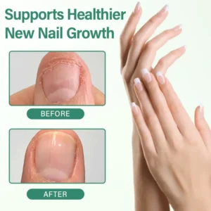 Nail Detox Penetration Serum Pen - Image 7