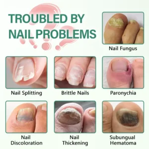 Nail Detox Penetration Serum Pen - Image 8
