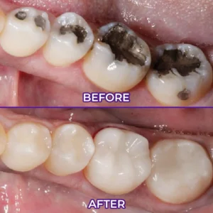 VioletX Advanced Whitening Complex - Image 2