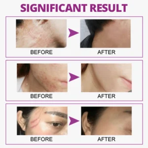 Cicatrix Healing Cream - Image 8