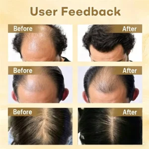 Hair Regrowth Capsules - Image 2