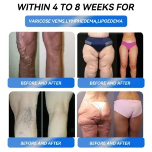 Slimming Support Drops - Image 5