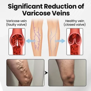 Leg Vein Magnet Ankle Bracelet - Image 4