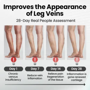 Leg Vein Magnet Ankle Bracelet - Image 6