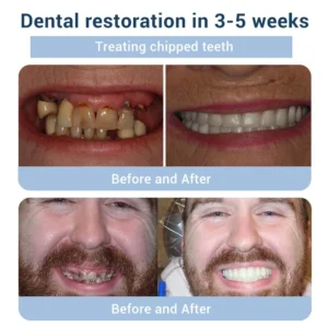 TeethRestoration Toothpaste Gel - Image 7