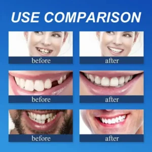 🌎Ends Today: 70% OFF! Medical Full Denture with Strong Suctiond - Image 6