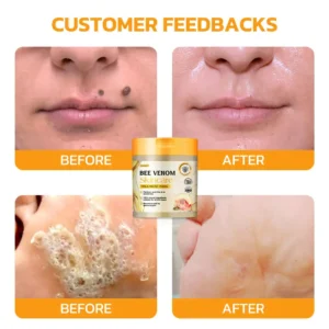 Bee Venom Skincare Treatment Pads - Image 5