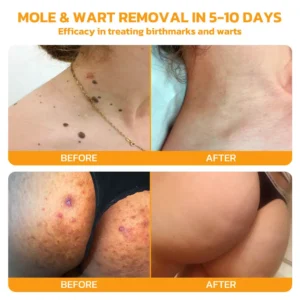 Bee Venom Skincare Treatment Pads - Image 7