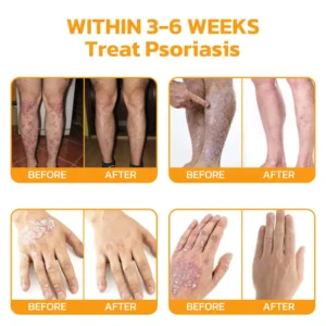 Bee Venom Skincare Treatment Pads - Image 9