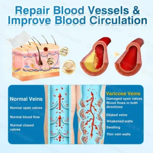 VeinRepair Microneedle Patch Roll - Image 12