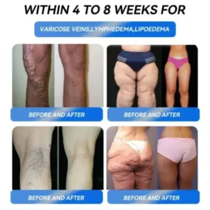 Weight Loss Oral Solution - Image 5