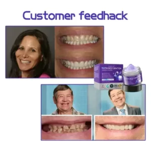 Teeth Restoration Mineral Powder - Image 7
