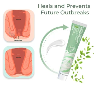 German Hemorrhoid Relief Cream - Image 4