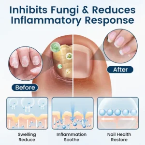 OnyxiGuard Fungal Repair Herbal Spray - Image 3