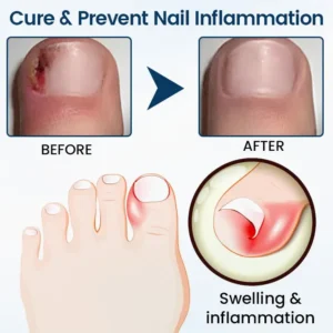 OnyxiGuard Fungal Repair Herbal Spray - Image 7