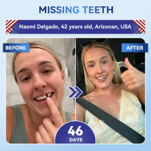 Tideglusib Fast‑Dissolving Tooth & Gum Repair Oral Strips - Image 9